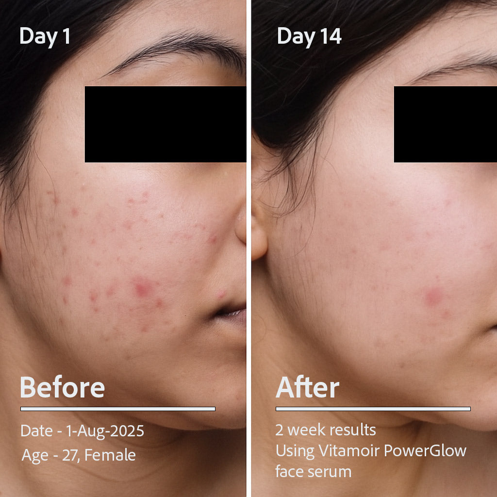 PowerGlow Vitamin C+ Serum