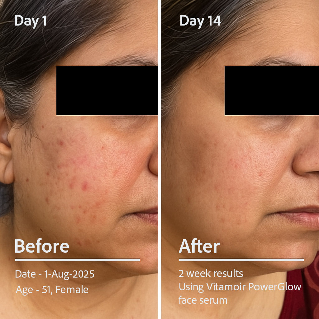 PowerGlow Vitamin C+ Serum