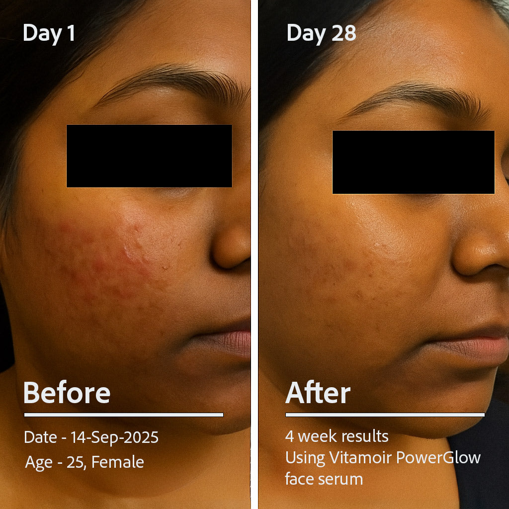 PowerGlow Vitamin C+ Serum