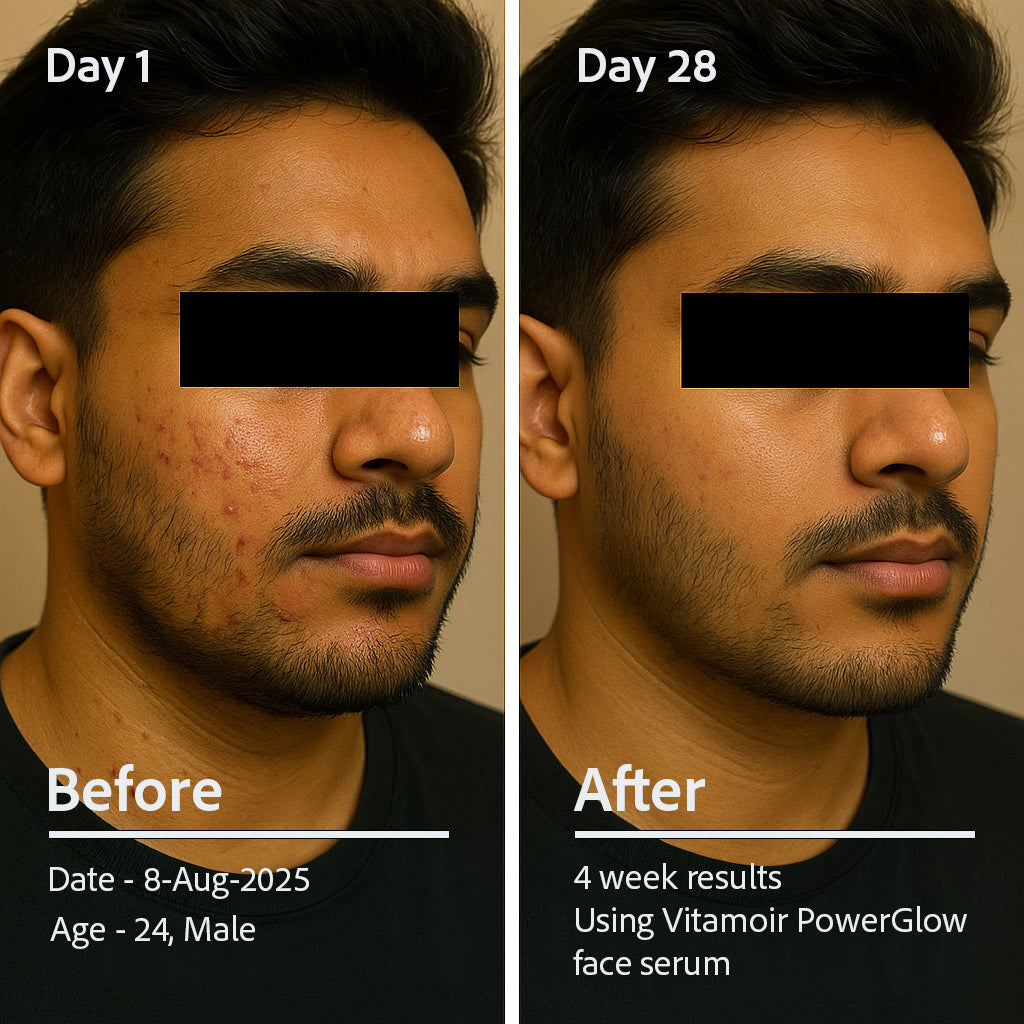 PowerGlow Vitamin C+ Serum