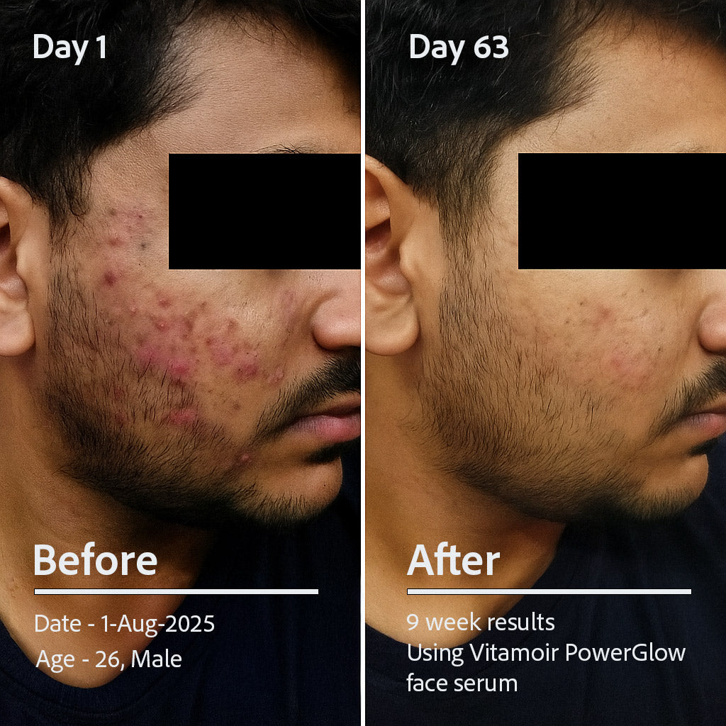 PowerGlow Vitamin C+ Serum